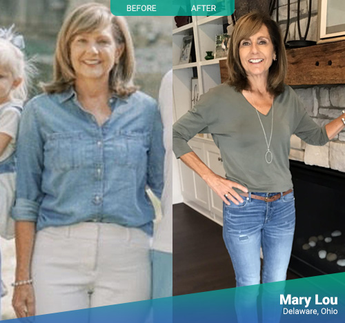 Mary Lou - Before & After