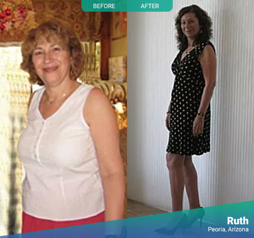Ruth - Before & After